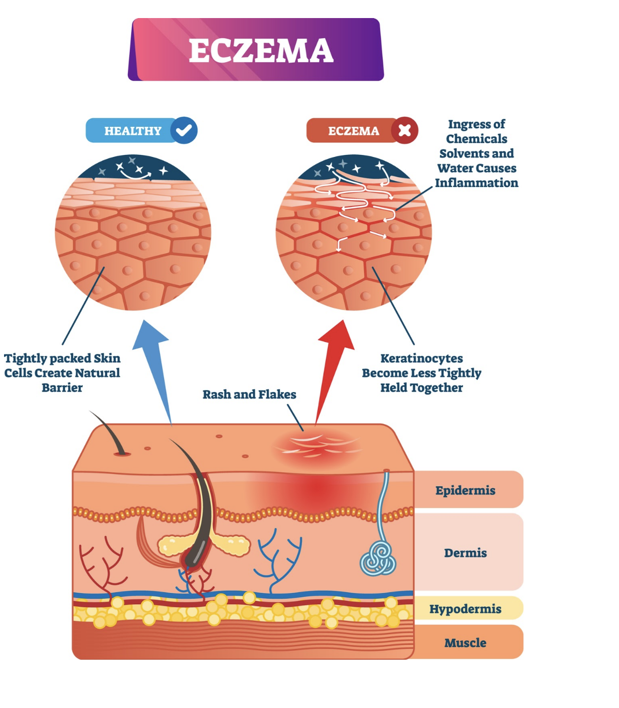 How CBD Oil Can Treat Acne, Eczema, & Psoriasis Dr. Michelle Jeffries