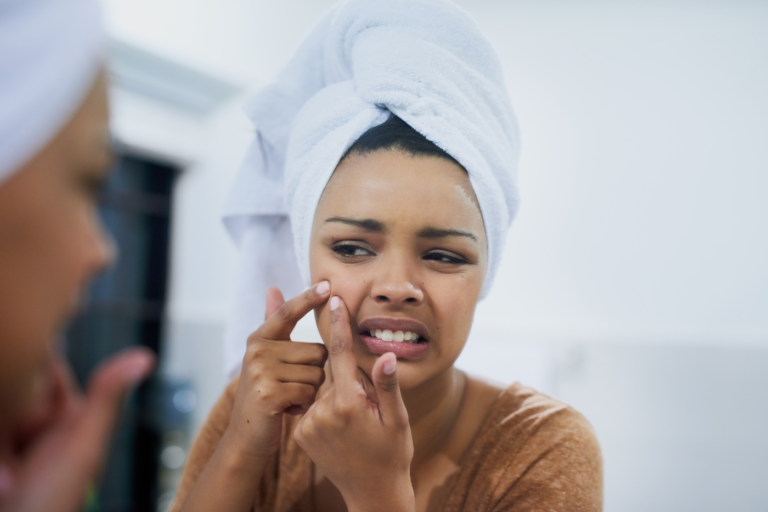 Do Pimple Patches Actually Work? Dr. Michelle Jeffries